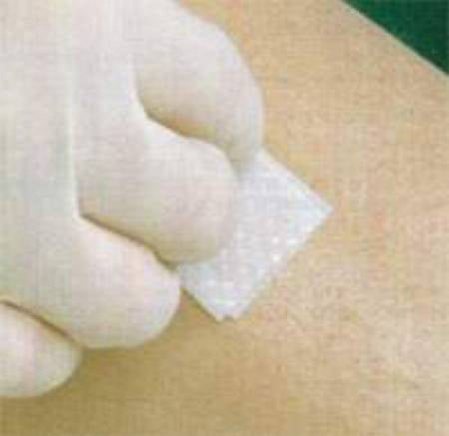 Prep Wipe No-Sting Skin-Prep - Item Number 59420600CS - 1000 Each / Case - image 1 of 1