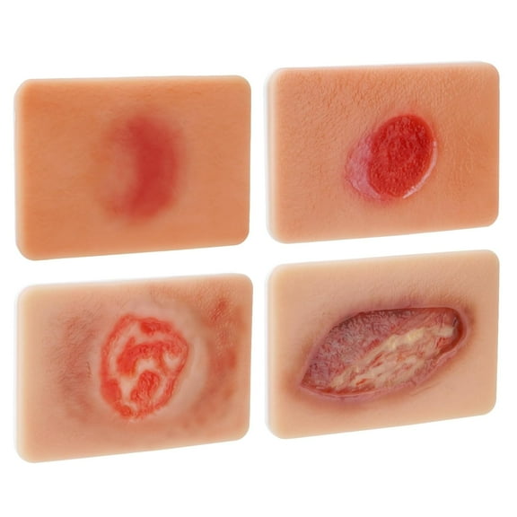 Pressure Ulcer Wound Model Stages I–IV: Silicone Decubitus Care Training Kit for Nursing Practice & Medical Education
