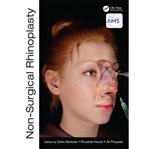Prime: Non-Surgical Rhinoplasty (Hardcover)