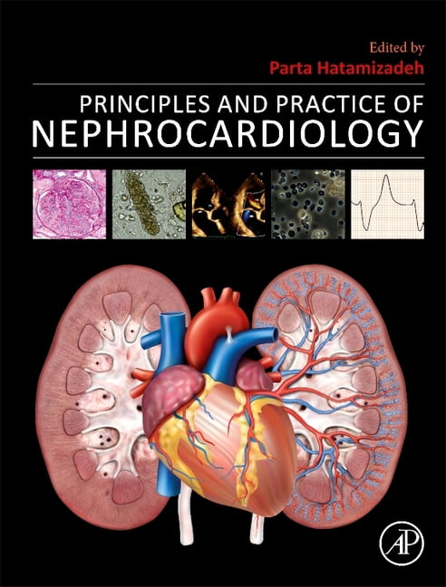 Principles and Practice of Nephrocardiology, (Hardcover)
