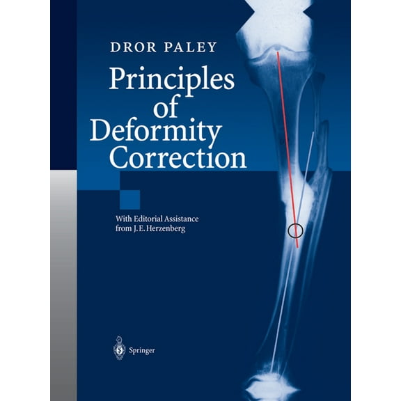 Principles of Deformity Correction, (Paperback)