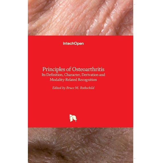 Principles of Osteoarthritis: Its Definition, Character, Derivation and Modality-Related Recognition (Hardcover)