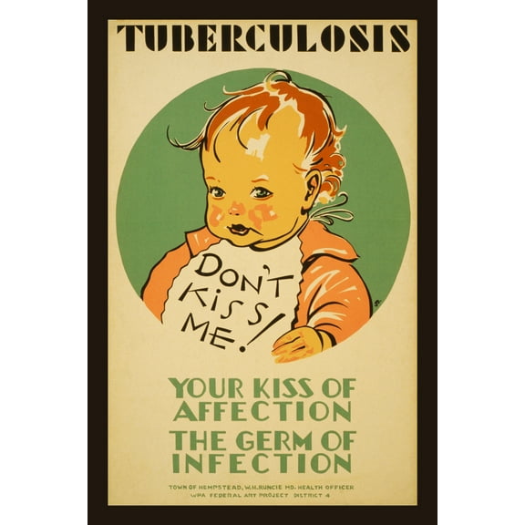 Print: Tuberculosis Don't Kiss Me! : Your Kiss Of Affection - The Germ Of