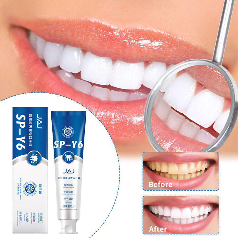 Probiotics Toothpaste Stain Remover Toothpaste Reducing Bad Breath Oral