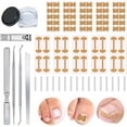 thumbnail image 1 of Professional Ingrown Toenail Set with Breathable Ingrown Toenail Strips, Curved Toenails Corrector Patch, Painless File and Lifter Pedicure Tools, 1 of 9