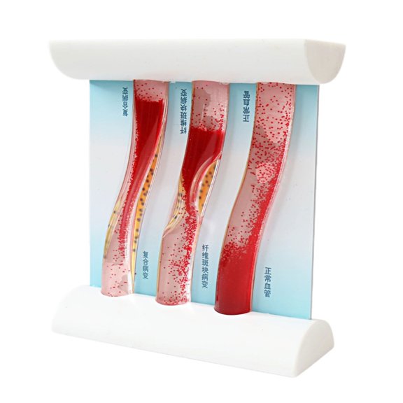 Professional Medicals Education Tool Featuring Reslistic Blood Vessel Structure And Interactive Dynamic Demonstration