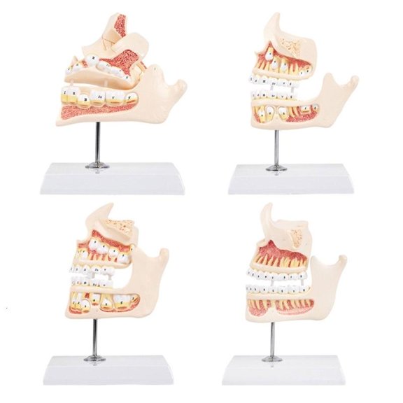 Professional Teaching Teeth Demonstration Model Showing Teeth Development Stage Ideal For Schools And Clinics