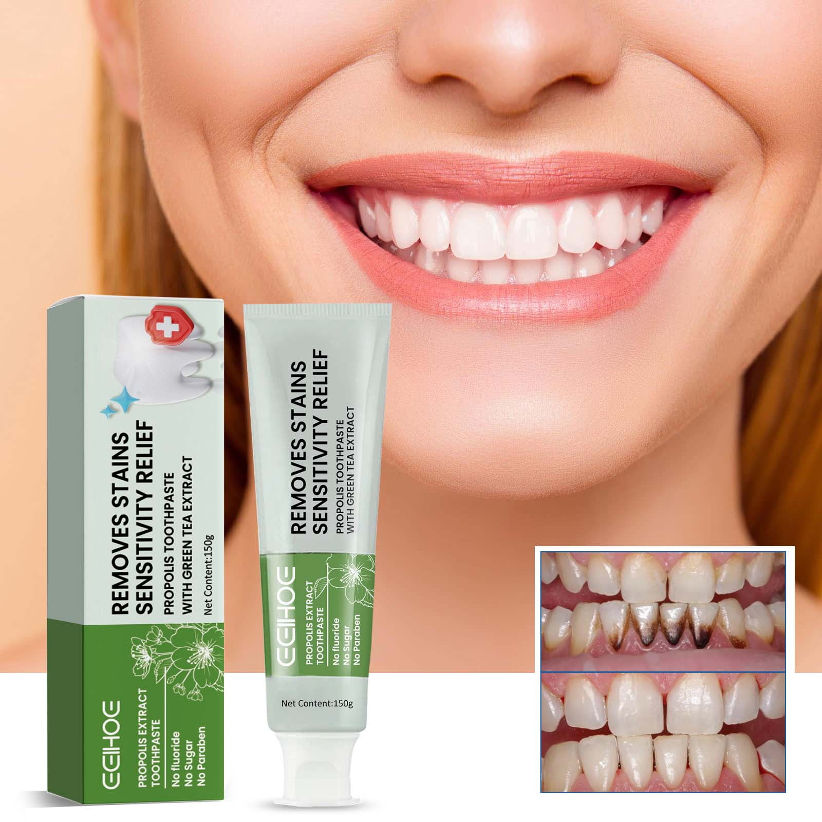 Propolis Toothpaste, Clean Stains Fresh Breath Tooth Whitening