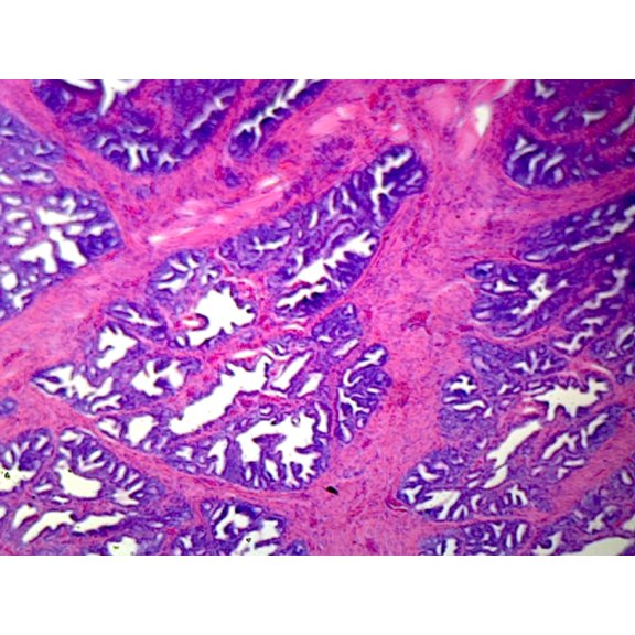 Prostate, Human; Showing Glandular Epithelium; Section; H&E Stain by Go Science Crazy