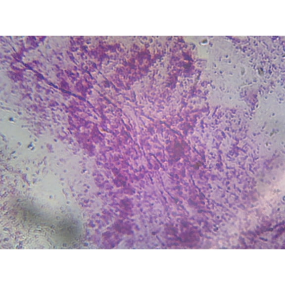 Pseudomonas Aeruginosa; Smear; Gram-Negative by Go Science Crazy