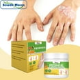 Psoriasis Soothing Cream Antibacterial Effective Anti Itching Rash