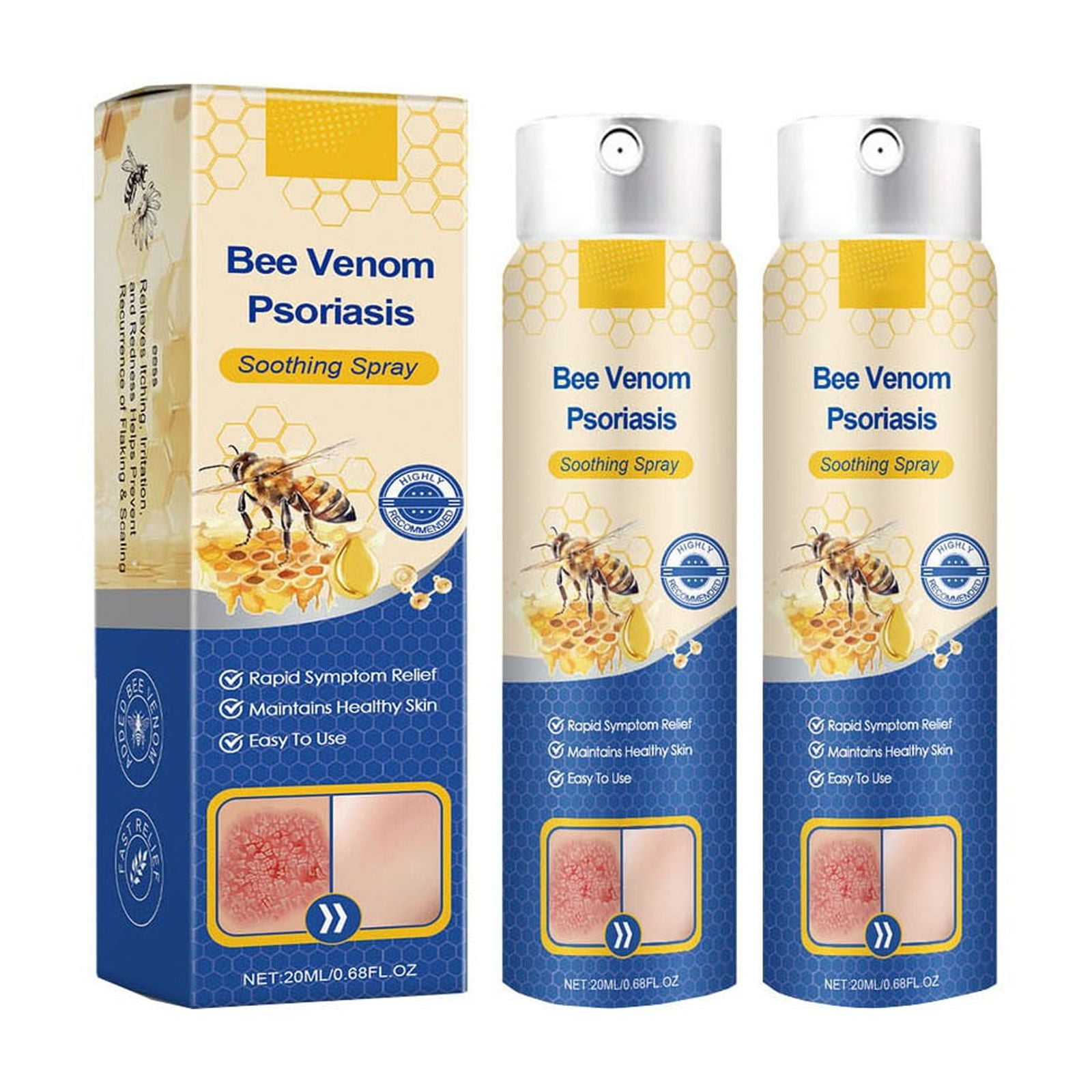 Psoriasis Spray For Daily Comfort. Forms A Moisturizing Barrier To Keep ...
