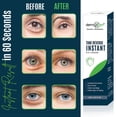 thumbnail image 1 of INSTANT EYEBAG REMOVER - TIME REVERSE- Visibly Reduce Under-Eye Bags, Wrinkles, Dark Circles, Fine Lines & Crow's Feet Instantly, 1 of 9