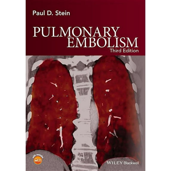 Pulmonary Embolism, (Hardcover)