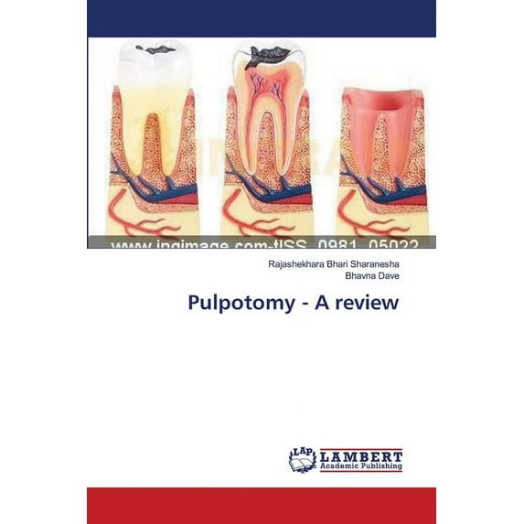 Pulpotomy - A review (Paperback)