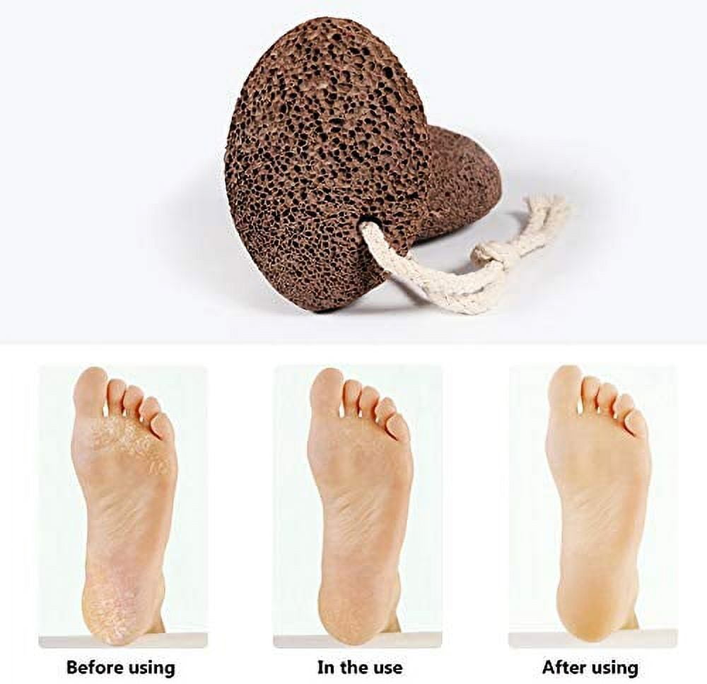 GetUSCart- Karlash Professional Pedicure Foot Pumice Stone for