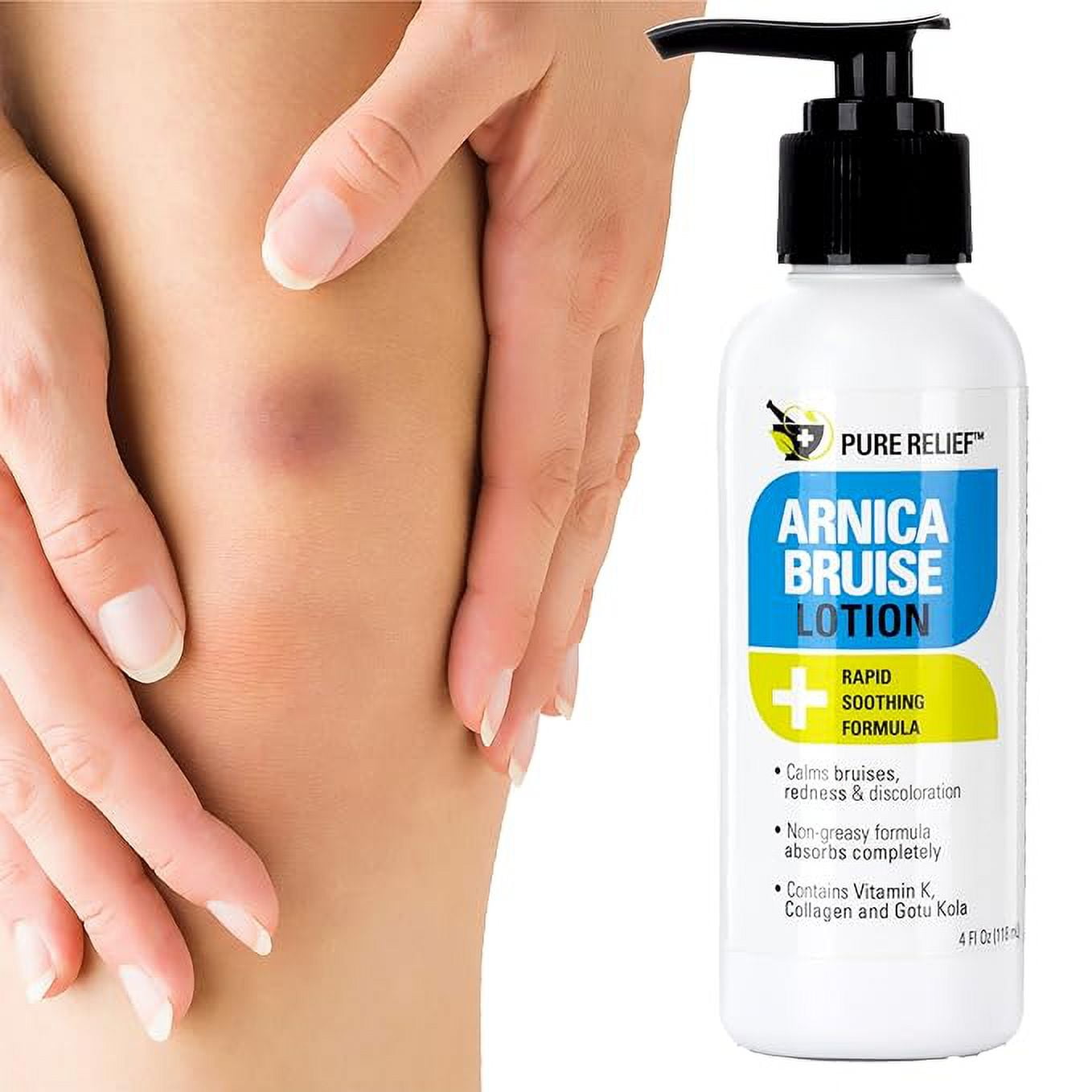 Pure Relief Arnica Cream Bruise Relief Lotion For Bruising And Swelling
