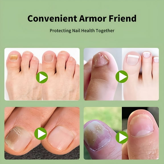 QARUN 5Pairs Nail Care Patch Ingrown Toenail Correction Patch Ingrown Toe Nail Treatment Soft Nail Repair Patch Foot Care Tool