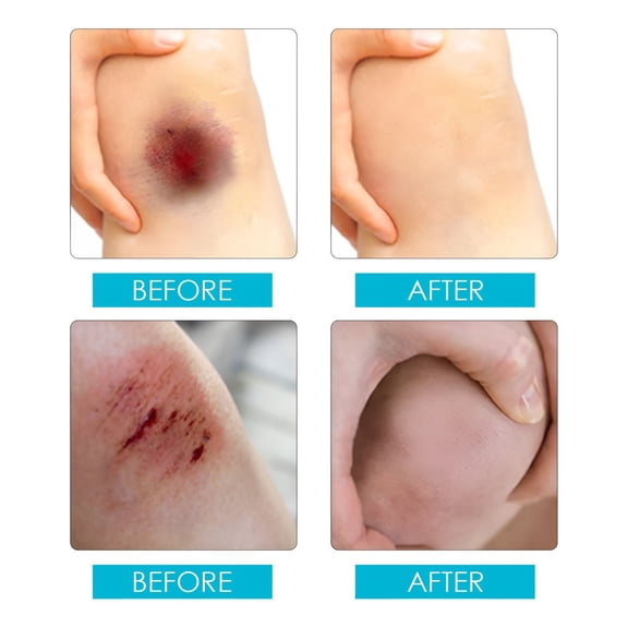QARUN Liquid Bandage Spray for Cuts, Breathable Skin Protector for Abrasions, Fast Drying Waterproof First Aid Seal, Travel and Home Care, 30ml