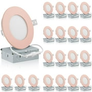 QPlus 4inch LED Recessed Lights, Aluminum Body, Daylight, Dimmable, 5000K, 20 Pack (Detachable Pink Trim)