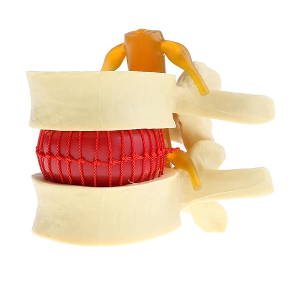 QSTDGVPW Human Spine Vertebrae Degenerative Disc Herniation Demonstration Model, Teaching