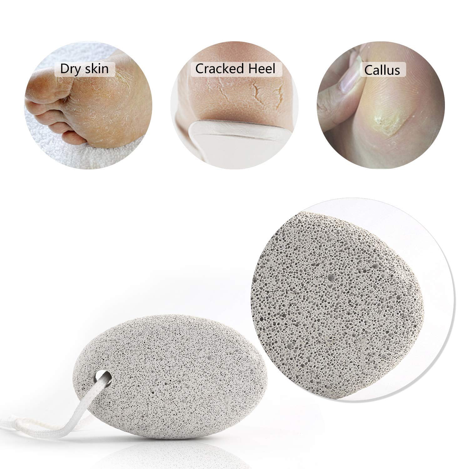 Qalabka Foot Care Pedicure Set, 3PCS Pumice Stone, Lava Rock, Callus Remover
