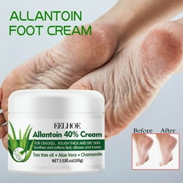 Blue goo foot cream clearance