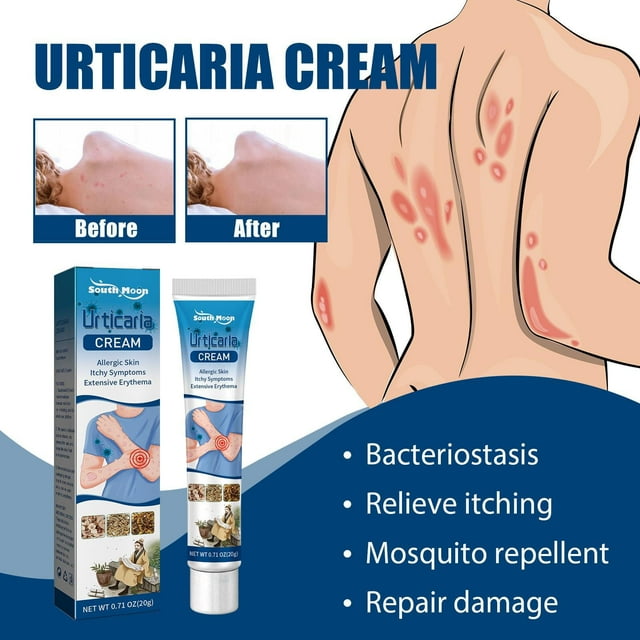Qesai Urticaria Cream , Herbal Material Plant Essence Fast Absorption