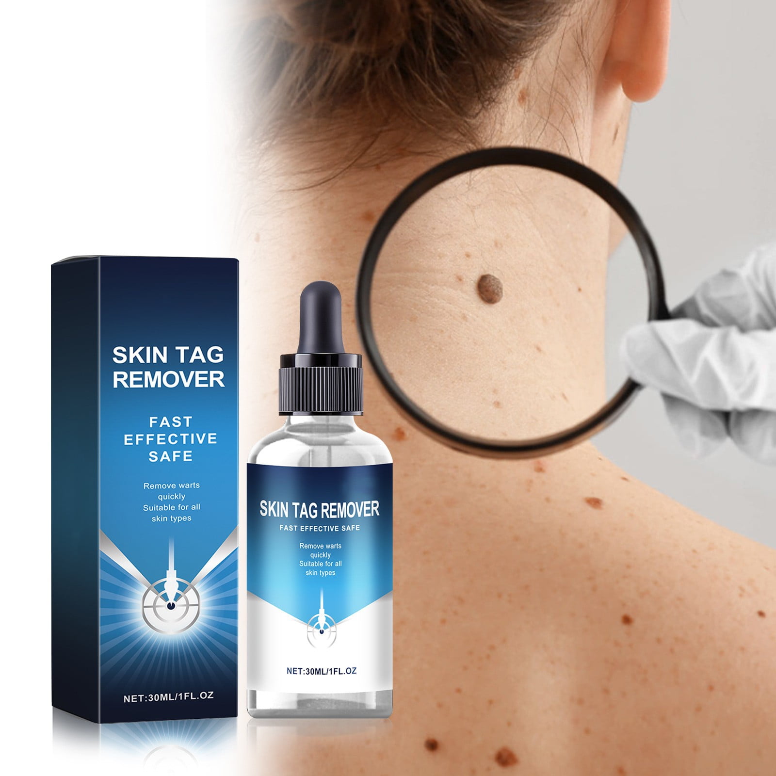 Qianvly Wart Remover, Quick Wart Remover, Suitable For Removing Warts, Moles And Skin Tags