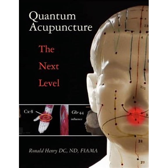 Quantum Acupuncture: - The Next Level (Paperback)