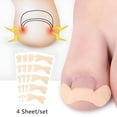 thumbnail image 1 of RAGUPEL 2026 New 20Pcs Toenail Corrector Ingrown Toe Foot Nail Correction Patch Nail Sticker Nail Repair Patches for Home,Salon,Spa,Travel, 1 of 7