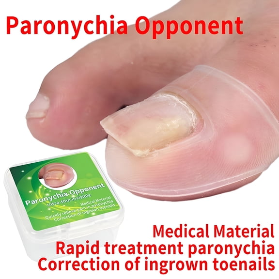 RAGUPEL 2026 New Silicone Ingrown Toenail Correction Tool Invisible Ingrown Toe Nail Treatment for Foot Care, Ingrown Toenail Relief, Home Treatment, Nail Health