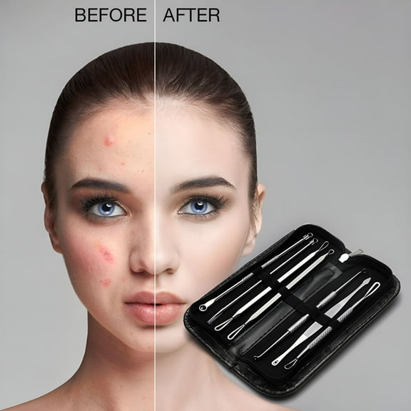 RAGUPEL Blackhead Remover Pimple Tool Comedone Zit Extractor Kit for Nose Facial Pore Extraction Popping Needle