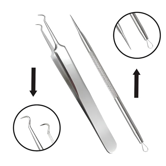 BPPEG Splinter Remover Tools - Cure Pimples, Whiteheads, Comedones, Acne, Zit, Ingrown Hairs
