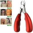 thumbnail image 1 of RAGUPEL YEESAM Podiatrist Toenail Clippers, Professional Thick & Ingrown Toe Nail Clippers for Elderly & Seniors, Red, 1 of 5