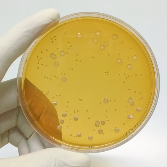 RENACLIPY 10Pcs Agar Plates for Laboratory with Prepoured Agar and Easy Carry Design