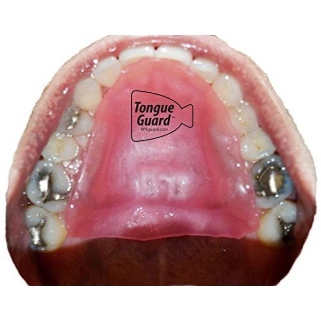 RPE Tongue Guard Prevents and Helps Heal Tongue Sores Caused by Dental