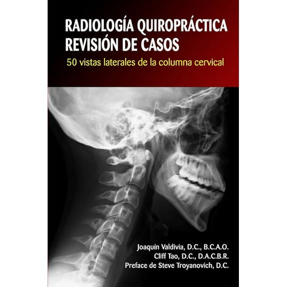 Radiologa Quiroprctica: REVISIN DE CASOS. 50 vistas laterales de la columna cervical (Paperback)