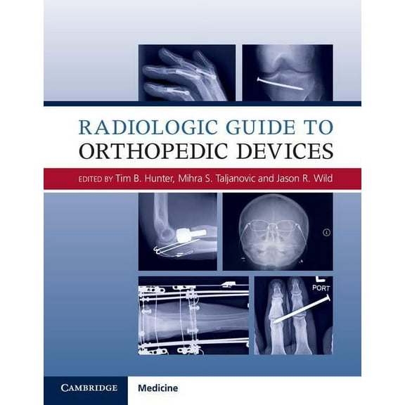 Radiologic Guide to Orthopedic Devices, (Hardcover)