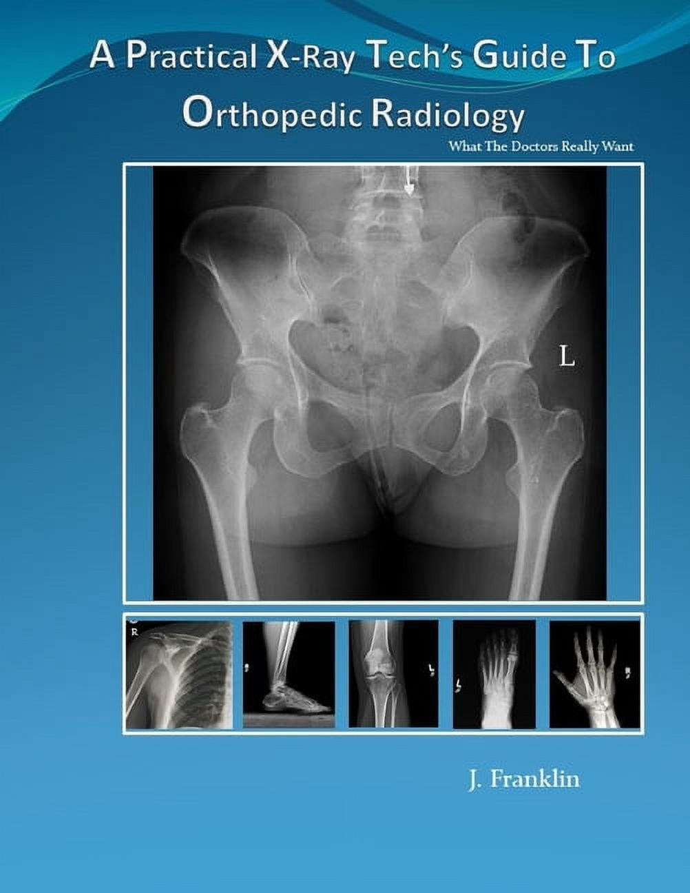 want　Practical　Tech's　Radiology:　(Paperback)　What　Guide　(Series　Orthopedic　To　A　X-Ray　really　Doctors　Radiology　the　#1)