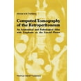 thumbnail image 1 of Radiology Computed Tomography of the Retroperitoneum: An Anatomical and Pathological Atlas with Emphasis on the Fascial Planes, Book 8, (Hardcover), 1 of 1