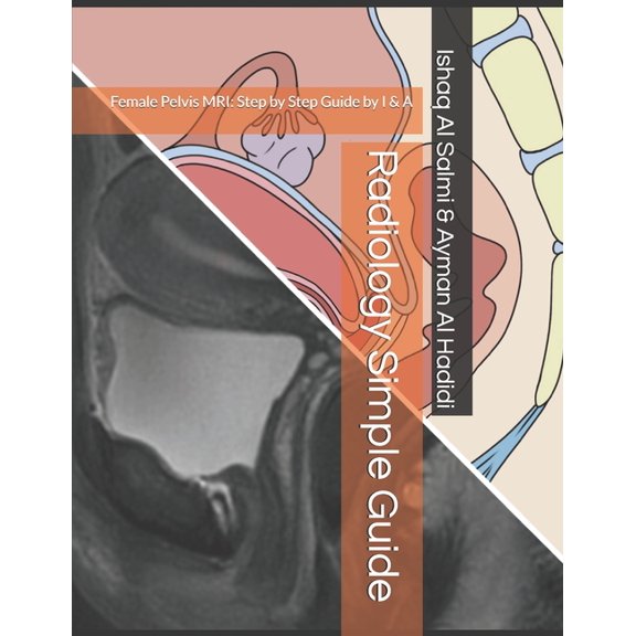 Radiology Simple Guide: Female Pelvis MRI: Step by Step Guide by I & A, (Paperback)
