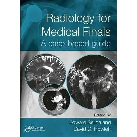 Radiology for Medical Finals: A Case-Based Guide (Paperback)