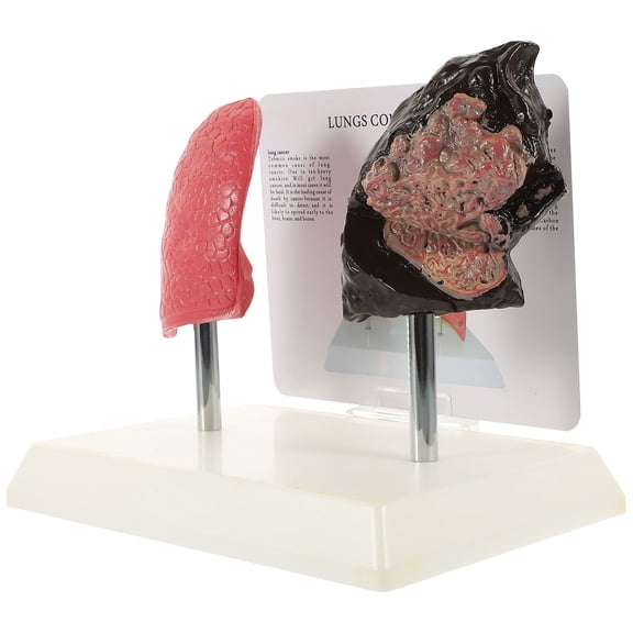 FOMIYES Lung Anatomy Model Multi PVC for Home Teaching and Schools 1Pc