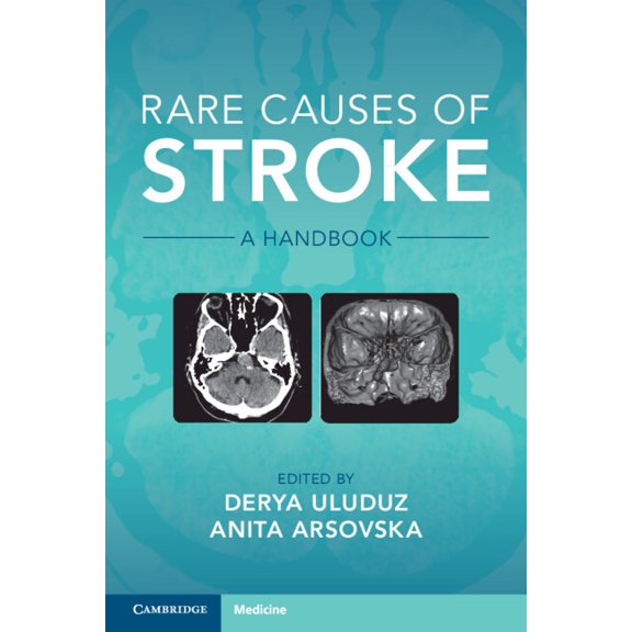 Rare Causes of Stroke: A Handbook, (Paperback)