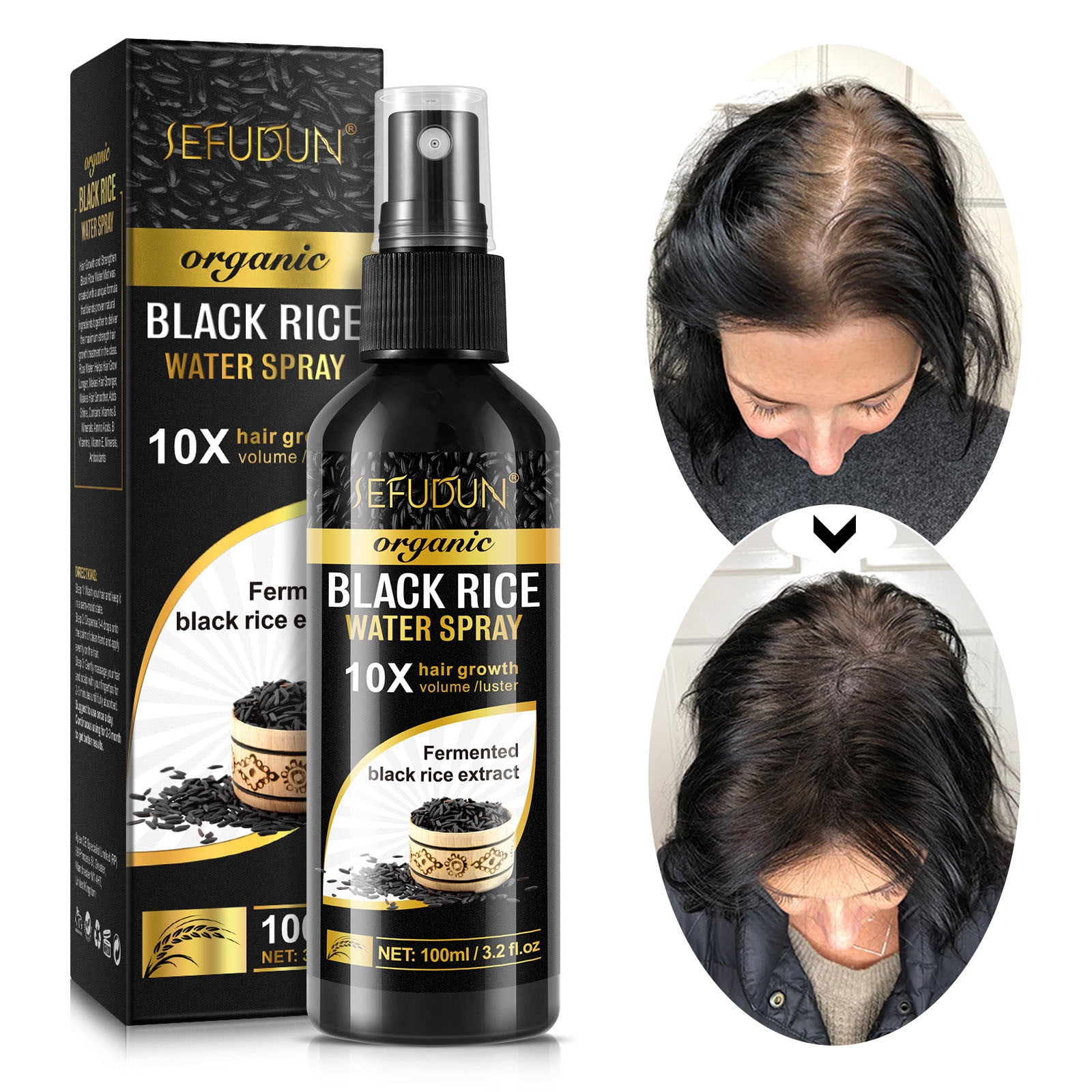 Rdeuod Hair Beauty Tools,Black Rice Water Hair Growth For Thinning Hair