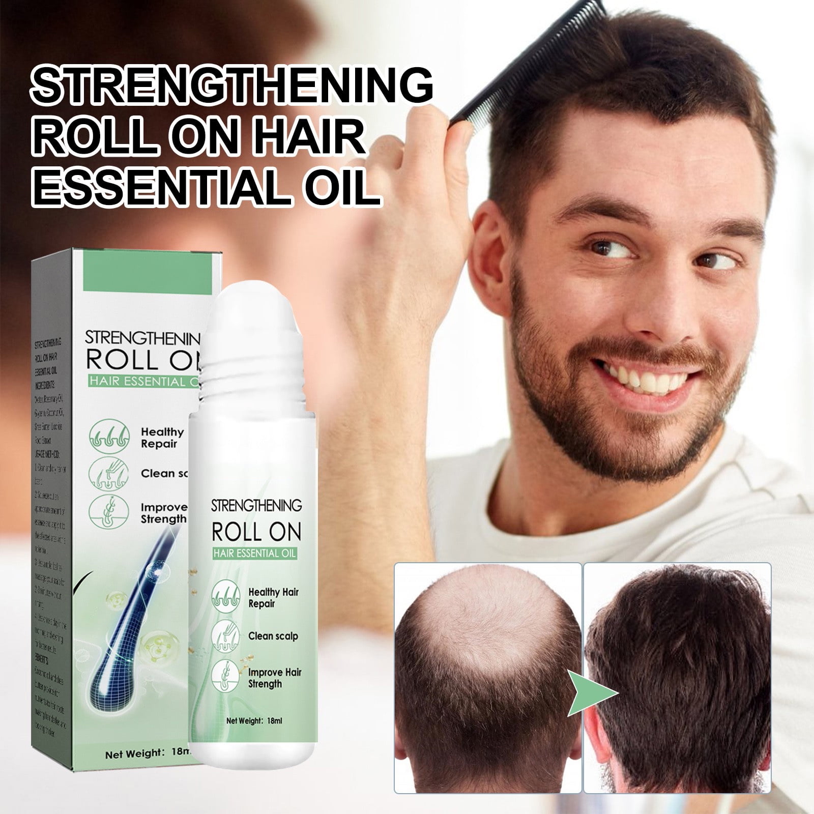 Rdeuod RenewHairX, RenewHair X RollOn Hair Treatment,2023 New