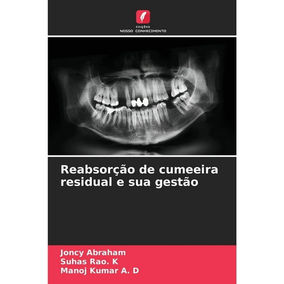 Reabsorção de cumeeira residual e sua gestão (Paperback)