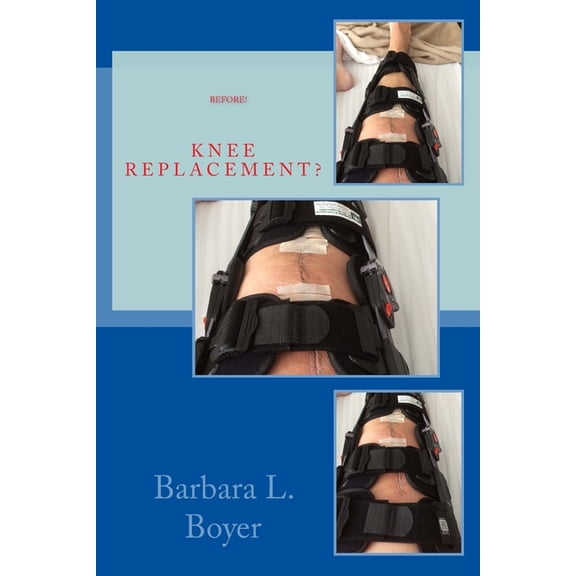 Read This Before Your Knee Replacement