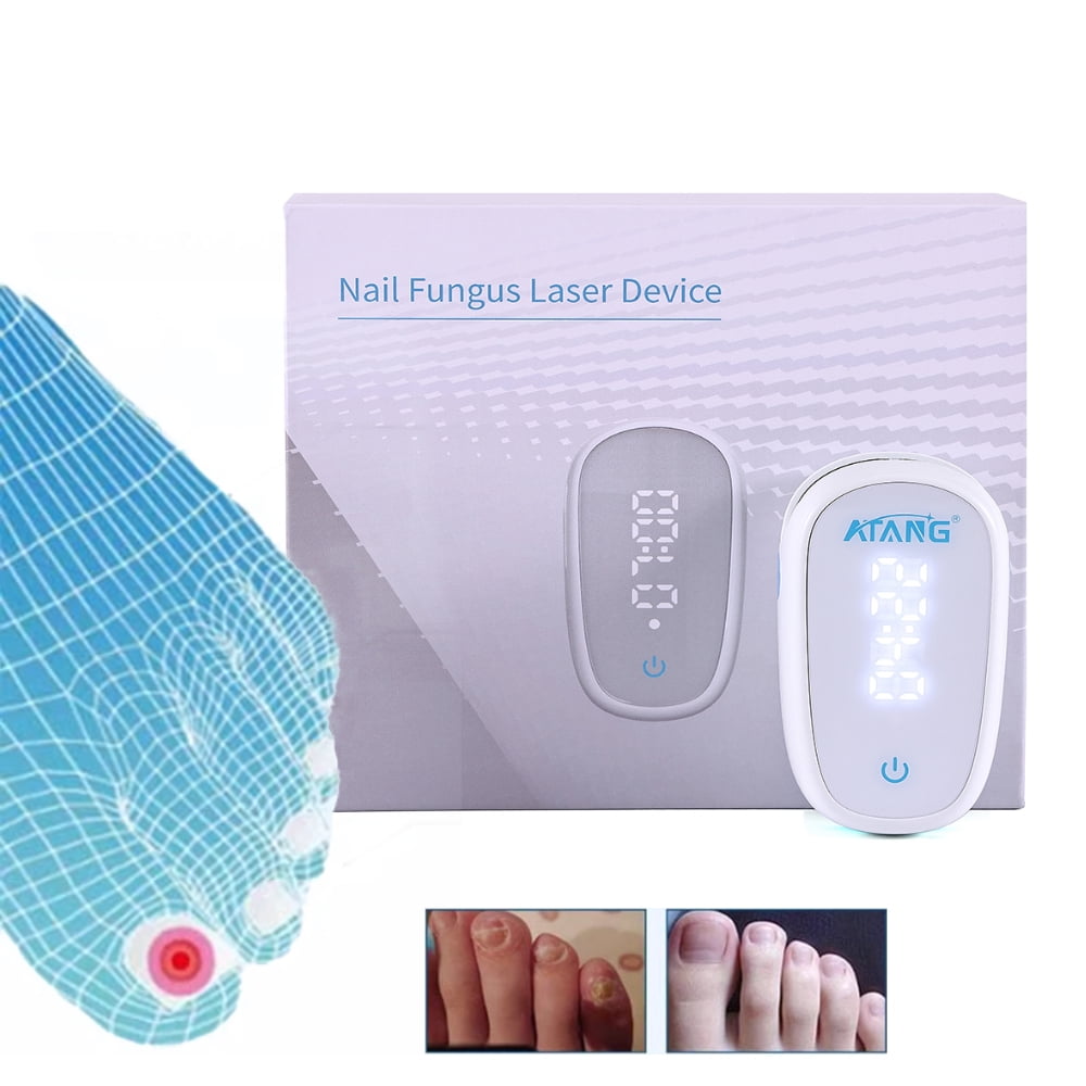 Rechargeable Nail Fungus Laser Treatment Device Cure Onychomycosis for Toe and Finger Nails Safe